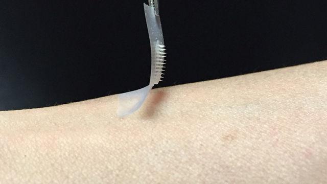 Diabetics could live a &#8216;sweet&#8217; life without needles